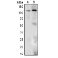 LifeSab™ DDX24 Rabbit pAb (50 µl)