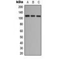 LifeSab™ EPHA7 (pY608) Rabbit pAb (50 µl)