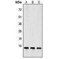 LifeSab™ FSH beta Rabbit pAb (50 µl)