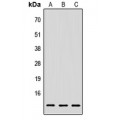 LifeSab™ LY6E Rabbit pAb (50 µl)