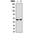 LifeSab™ MBTPS2 Rabbit pAb (50 µl)