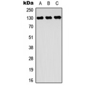 LifeSab™ ROR2 Rabbit pAb (50 µl)