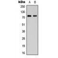 LifeSab™ CD92 Rabbit pAb (50 µl)