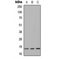 LifeSab™ SNCA Rabbit pAb (50 µl)