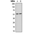 LifeSab™ SRF (pS103) Rabbit pAb (50 µl)