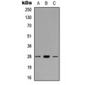 LifeSab™ BCL2 Rabbit pAb (50 µl)