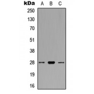 LifeSab™ BCL2 Rabbit pAb (50 µl)