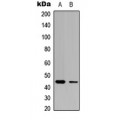 LifeSab™ CLN5 Rabbit pAb (50 µl)