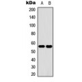 LifeSab™ CYP2C19 Rabbit pAb (50 µl)