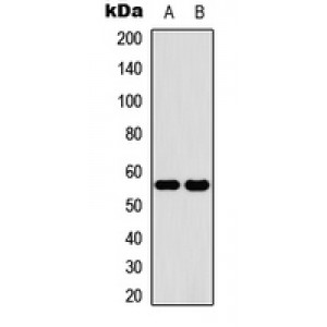 LifeSab™ CYP2C19 Rabbit pAb (50 µl)