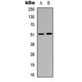LifeSab™ GABRA6 Rabbit pAb (50 µl)