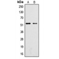 LifeSab™ SGK1 (pS422) Rabbit pAb (50 µl)