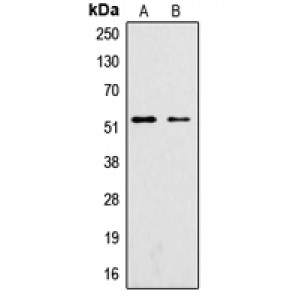 LifeSab™ SGK1 (pS422) Rabbit pAb (50 µl)