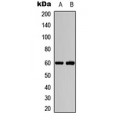 LifeSab™ AKT1/2 (pT308/309) Rabbit pAb (50 µl)