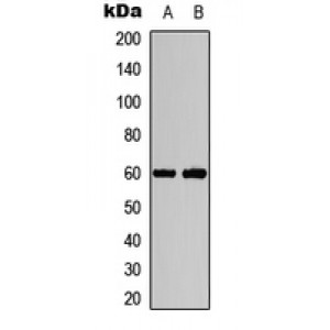 LifeSab™ AKT1/2 (pT308/309) Rabbit pAb (50 µl)