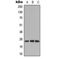 LifeSab™ CDCA4 Rabbit pAb (50 µl)