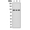 LifeSab™ c-FER Rabbit pAb (50 µl)