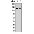LifeSab™ NMDAR1 Rabbit pAb (50 µl)