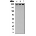 LifeSab™ NMDAR2B (pY1474) Rabbit pAb (50 µl)