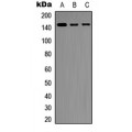 LifeSab™ SHIP1 Rabbit pAb (50 µl)