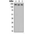 LifeSab™ VEGFR2 (pY951) Rabbit pAb (50 µl)