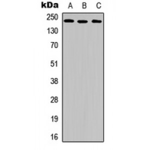 LifeSab™ VEGFR2 (pY951) Rabbit pAb (50 µl)