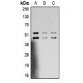 LifeSab™ JNK1/2/3 (pT183/Y185) Rabbit pAb (50 µl)