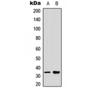LifeSab™ CRSP8 Rabbit pAb (50 µl)