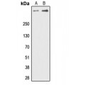 LifeSab™ PRKDC (pT2647) Rabbit pAb (50 µl)