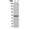 LifeSab™ UBXN11 Rabbit pAb (50 µl)