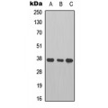 LifeSab™ Cathepsin B Rabbit pAb (50 µl)