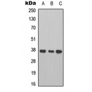 LifeSab™ Cathepsin B Rabbit pAb (50 µl)