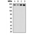 LifeSab™ HER3 Rabbit pAb (50 µl)