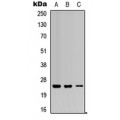 LifeSab™ RAB5C Rabbit pAb (50 µl)