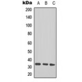 LifeSab™ TAL1/2 (AcK221+222/K36+37) Rabbit pAb (50 µl)