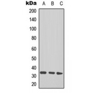 LifeSab™ TAL1/2 (AcK221+222/K36+37) Rabbit pAb (50 µl)