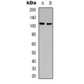 LifeSab™ GTF2IRD1 Rabbit pAb (50 µl)
