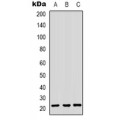 LifeSab™ CBX3 Rabbit pAb (50 µl)