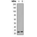 LifeSab™ SDC4 Rabbit pAb (50 µl)