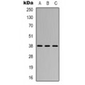 LifeSab™ CYSLTR1 Rabbit pAb (50 µl)