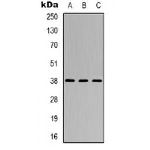 LifeSab™ CYSLTR1 Rabbit pAb (50 µl)