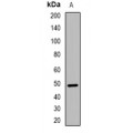 LifeSab™ CCNE1 (pT77) Rabbit pAb (50 µl)