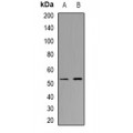 LifeSab™ CHST9 Rabbit pAb (50 µl)