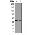 LifeSab™ p53 (TriMethyl K370) Rabbit pAb (50 µl)