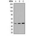 LifeSab™ MMP13 Rabbit pAb (50 µl)