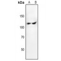 LifeSab™ PTK2 Rabbit pAb (50 µl)