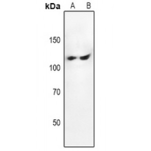 LifeSab™ PTK2 Rabbit pAb (50 µl)