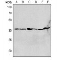 LifeSab™ CHRNA1 Rabbit pAb (50 µl)