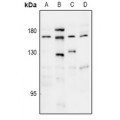LifeSab™ THBS1 Rabbit pAb (50 µl)