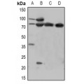 LifeSab™ CTNNB1 (pY670) Rabbit pAb (50 µl)